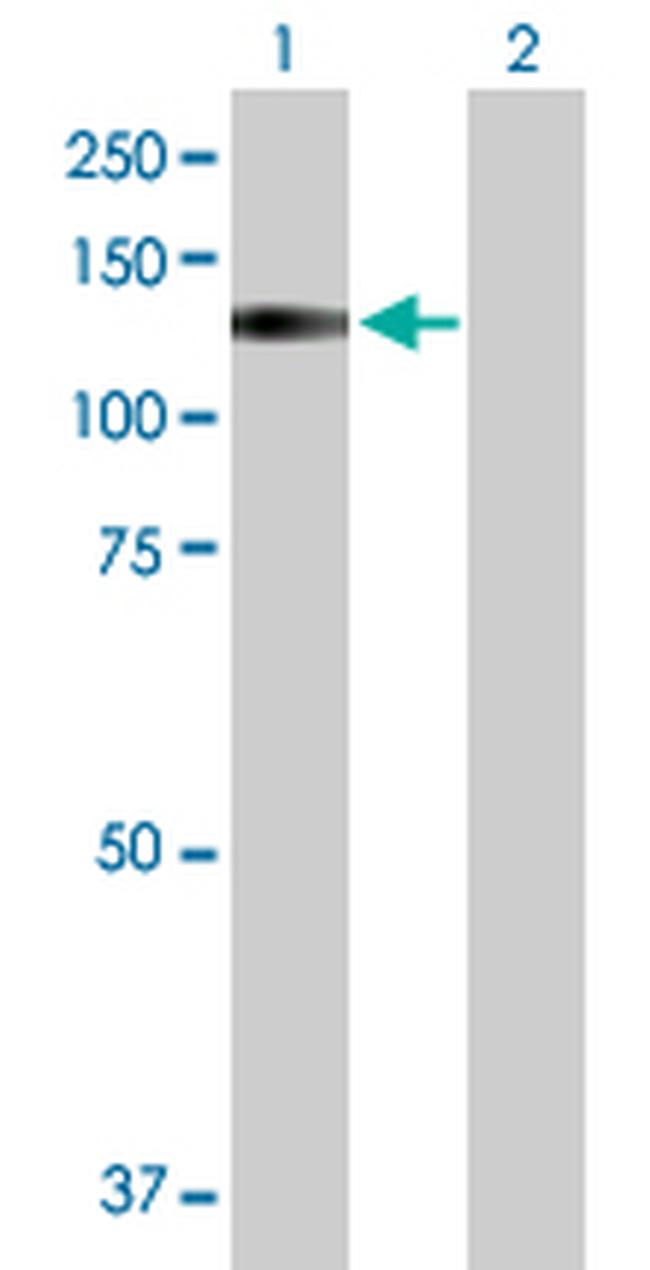 TRPA1 Antibody in Western Blot (WB)