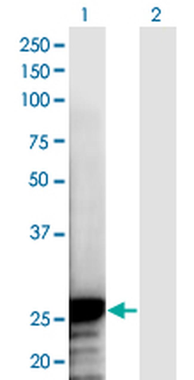 NOL3 Antibody in Western Blot (WB)