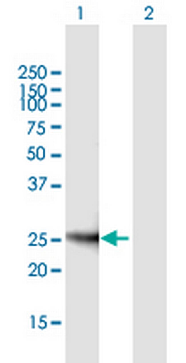 SOCS3 Antibody in Western Blot (WB)