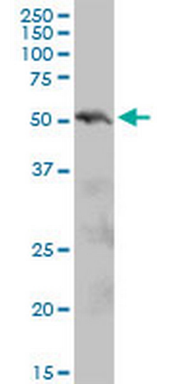 PIAS2 Antibody in Western Blot (WB)