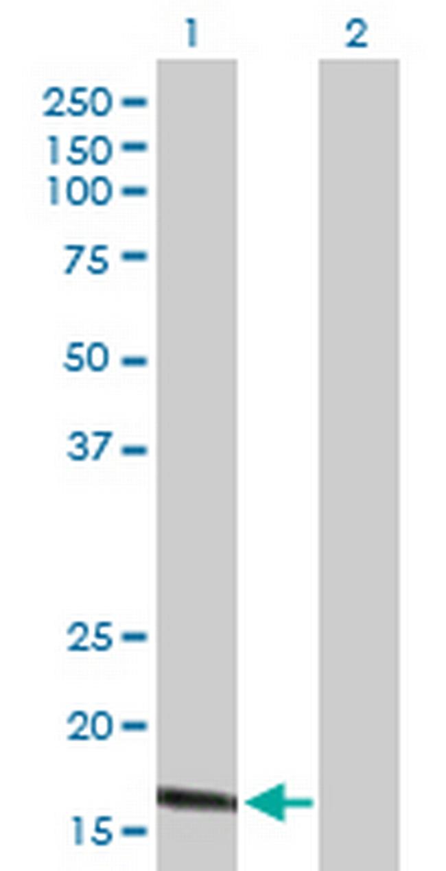 CLDN1 Antibody in Western Blot (WB)