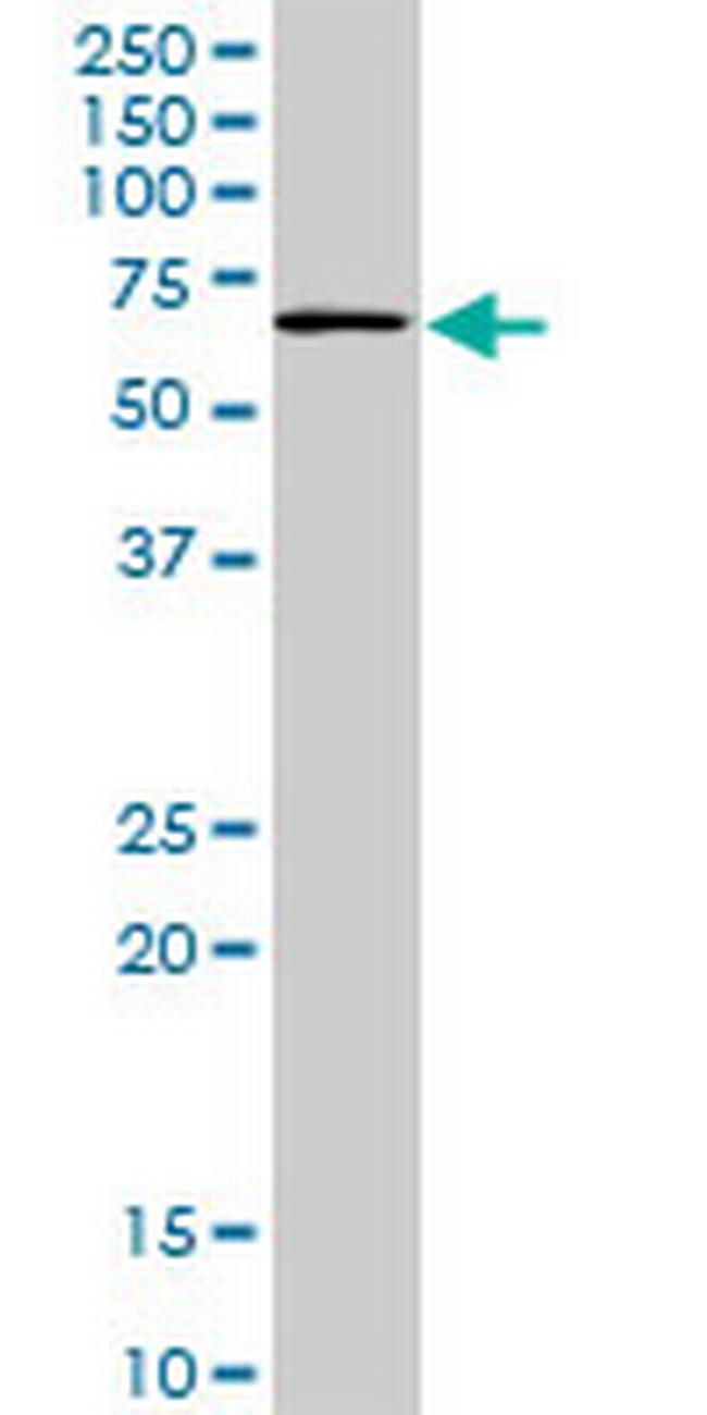 TBX18 Antibody in Western Blot (WB)