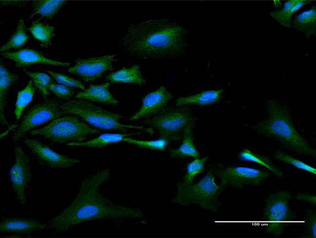 NMI Antibody in Immunocytochemistry (ICC/IF)