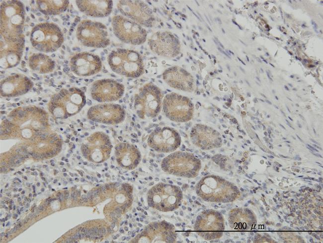 NMI Antibody in Immunohistochemistry (Paraffin) (IHC (P))