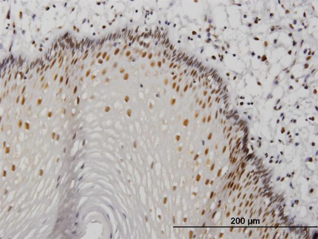 MTA1 Antibody in Immunohistochemistry (Paraffin) (IHC (P))