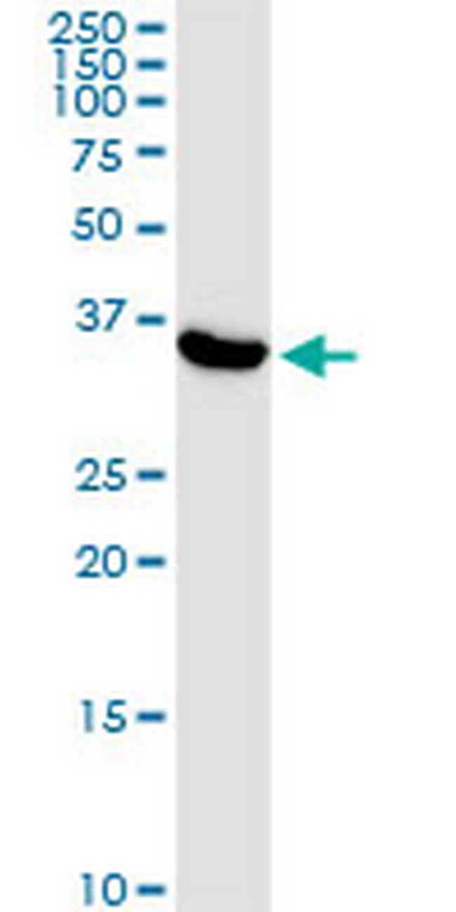 ATP6V0D1 Antibody in Western Blot (WB)