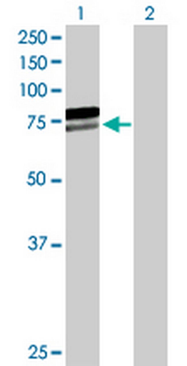 AIFM1 Antibody in Western Blot (WB)