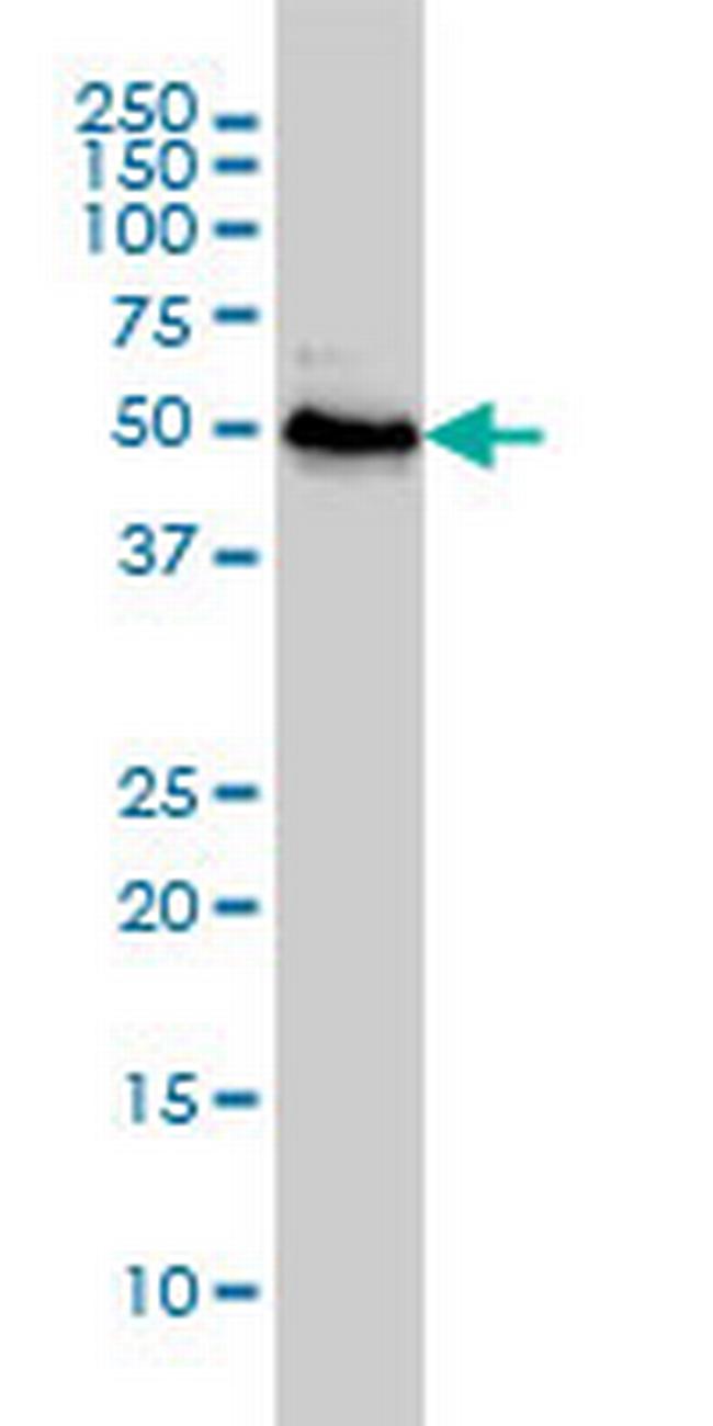 RNU3IP2 Antibody in Western Blot (WB)