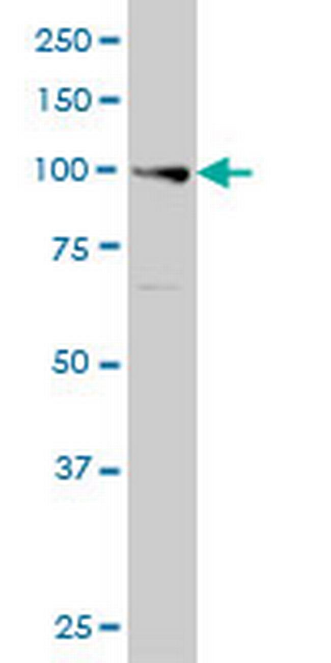 EXO1 Antibody in Western Blot (WB)