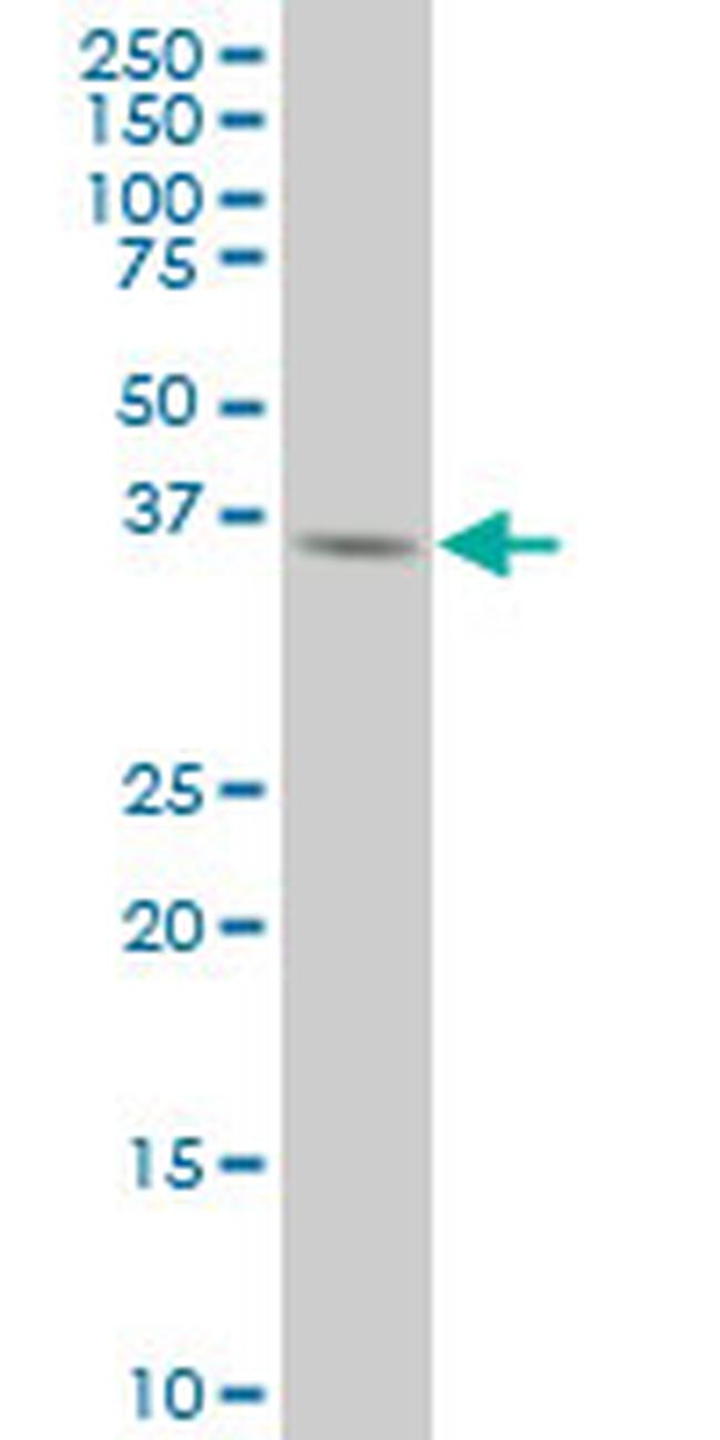 AURKB Antibody in Western Blot (WB)