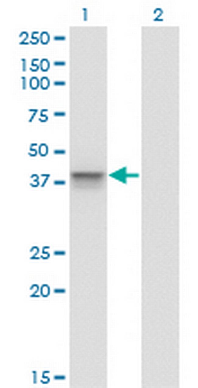 AURKB Antibody in Western Blot (WB)