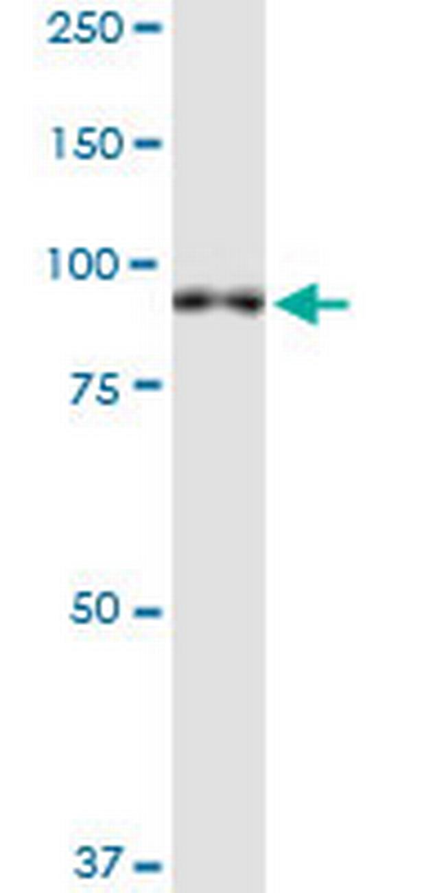 XPR1 Antibody in Western Blot (WB)