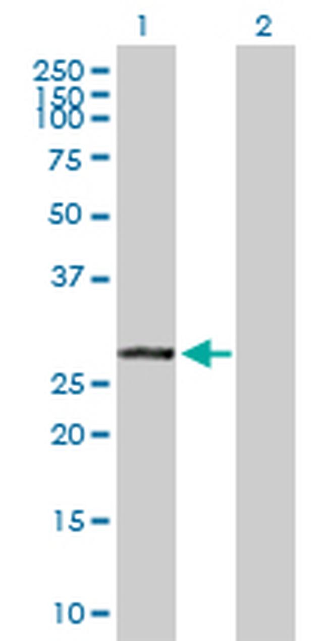 VAPB Antibody in Western Blot (WB)