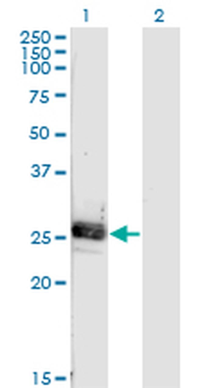 NOG Antibody in Western Blot (WB)