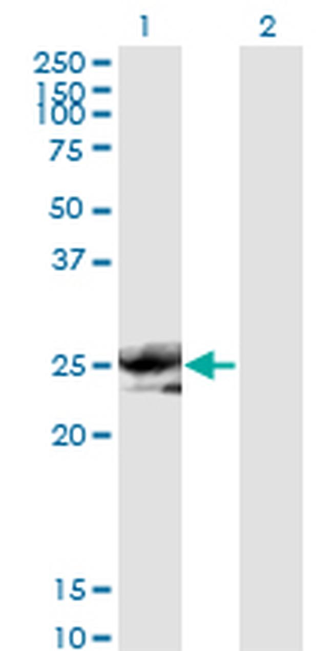 NOG Antibody in Western Blot (WB)