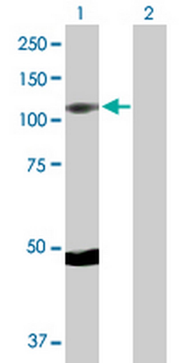 RPS6KA5 Antibody in Western Blot (WB)