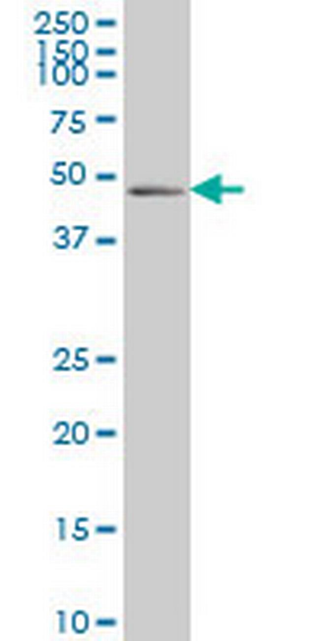 PDLIM7 Antibody in Western Blot (WB)