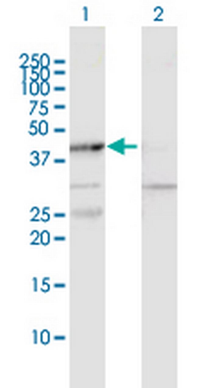 MAPKAPK2 Antibody in Western Blot (WB)