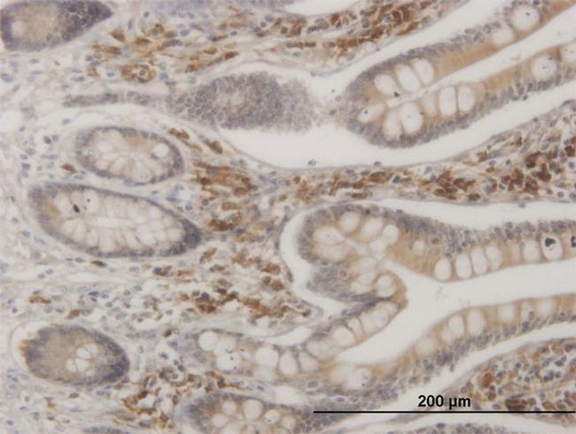 MAPKAPK2 Antibody in Immunohistochemistry (Paraffin) (IHC (P))