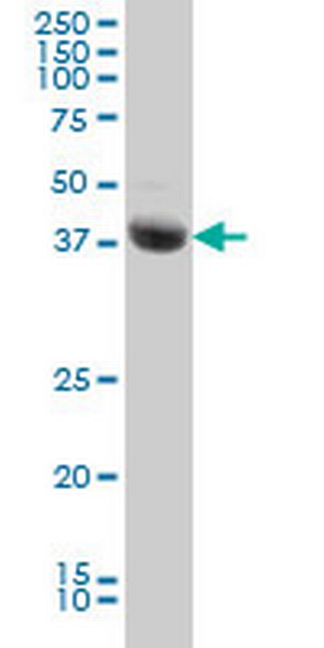 STK17B Antibody in Western Blot (WB)