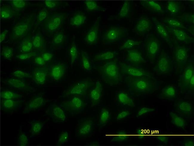 PSCD3 Antibody in Immunocytochemistry (ICC/IF)