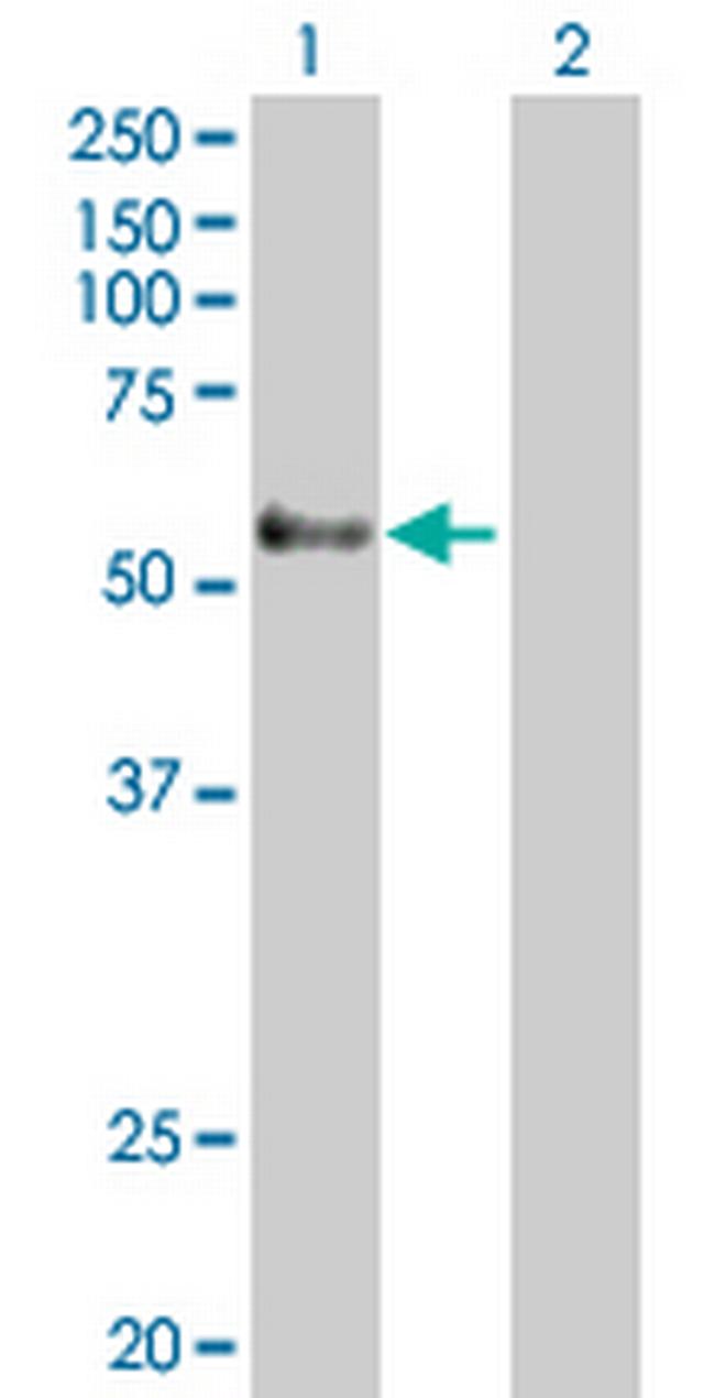 GPR56 Antibody in Western Blot (WB)