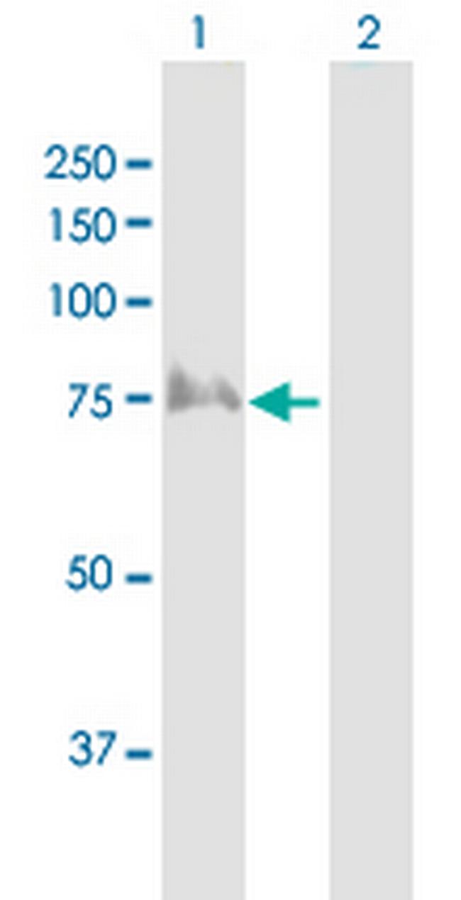 TRIP10 Antibody in Western Blot (WB)