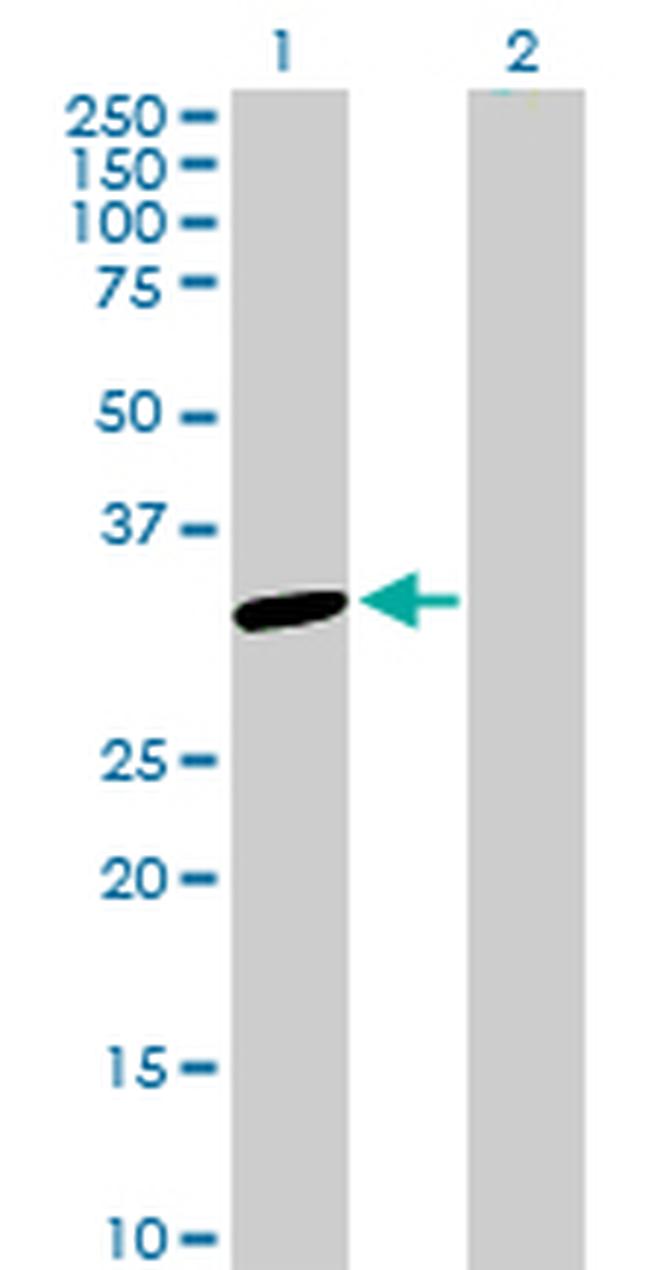 SNAP29 Antibody in Western Blot (WB)