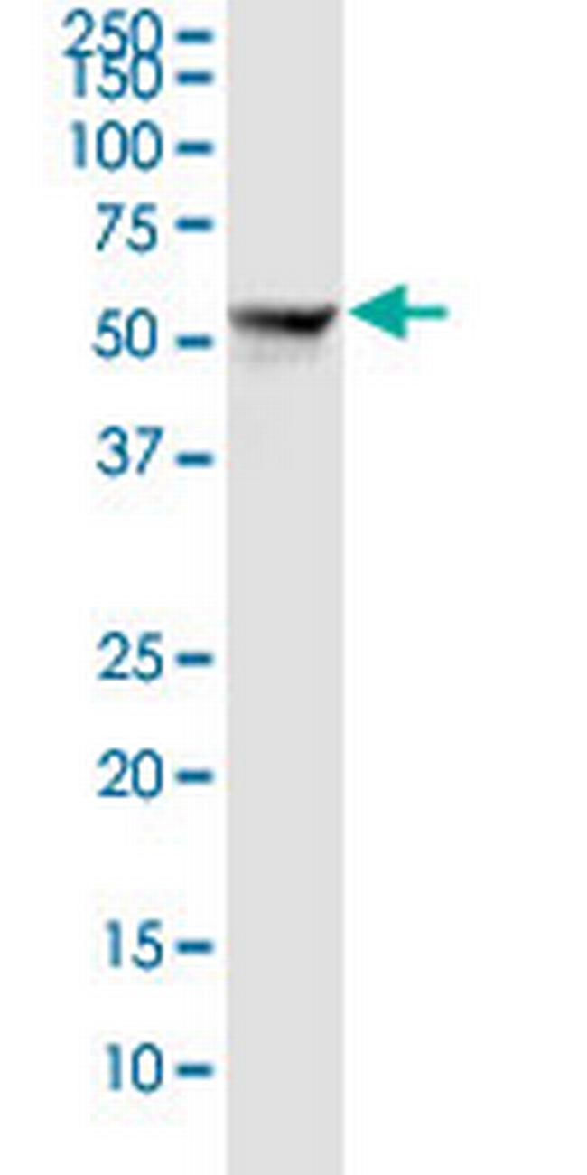 SLC22A8 Antibody in Western Blot (WB)