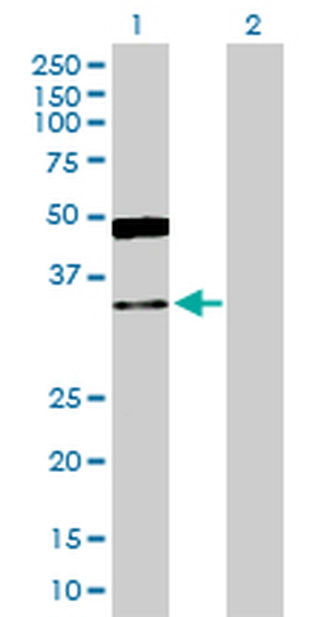 GRHPR Antibody in Western Blot (WB)