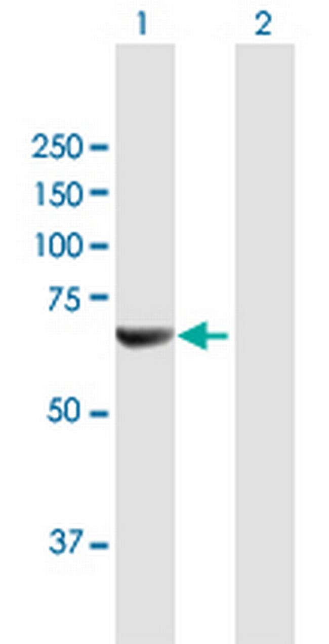 NMT2 Antibody in Western Blot (WB)