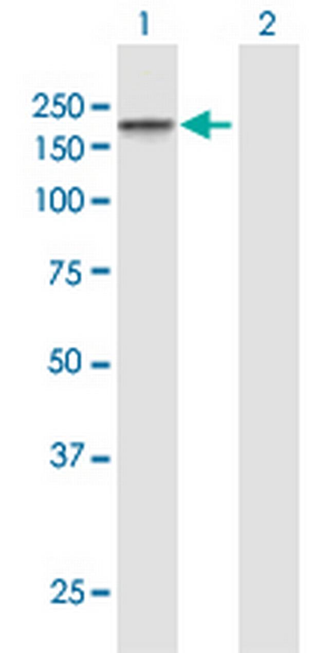 TJP2 Antibody in Western Blot (WB)