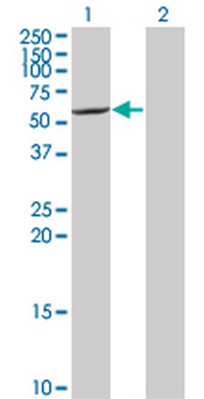 CYP7B1 Antibody in Western Blot (WB)