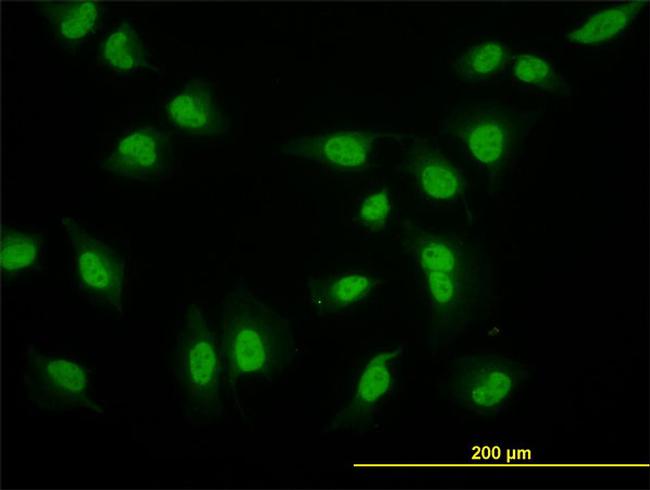 CRSP6 Antibody in Immunocytochemistry (ICC/IF)