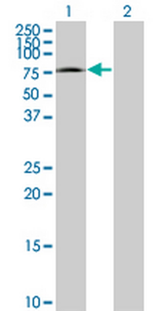 CRSP7 Antibody in Western Blot (WB)