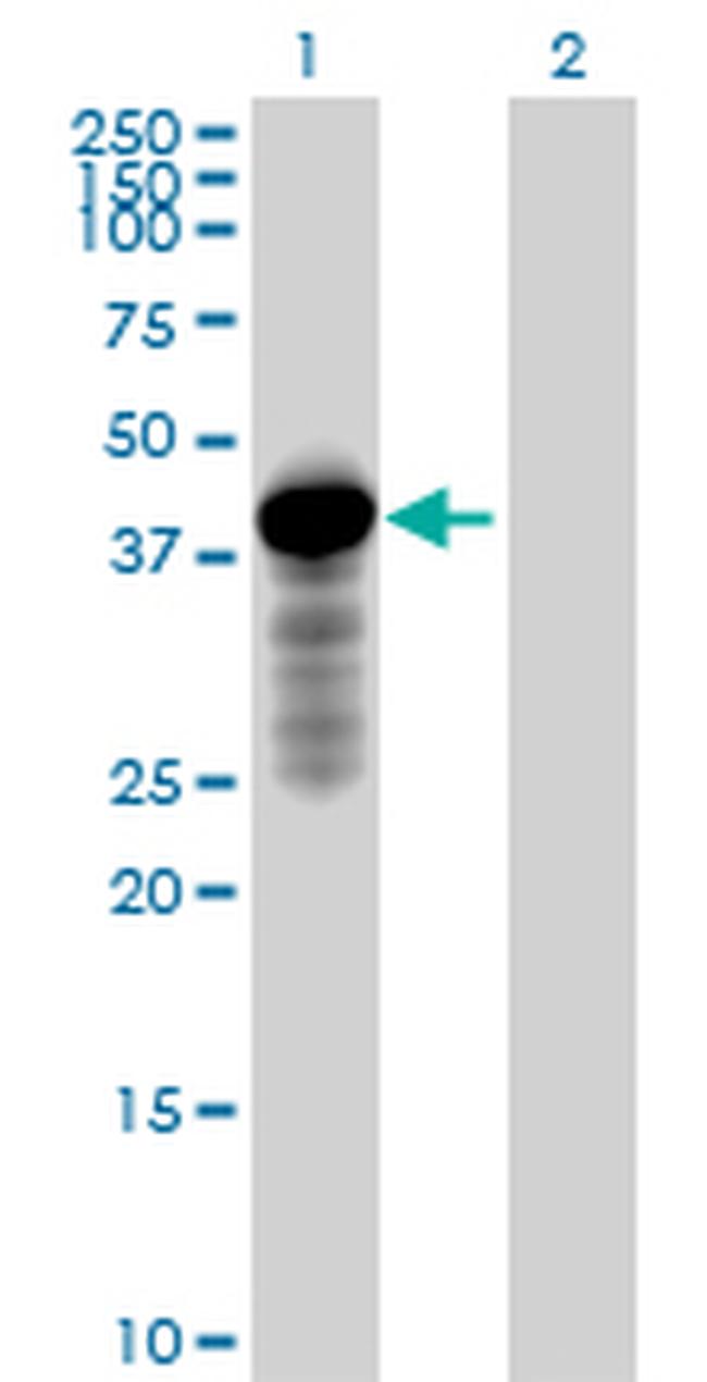 HOMER2 Antibody in Western Blot (WB)