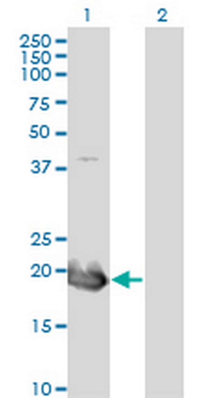 HAND2 Antibody in Western Blot (WB)