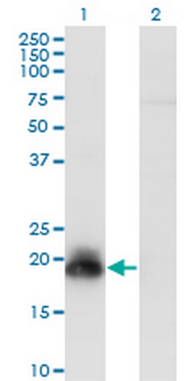 HAND2 Antibody in Western Blot (WB)