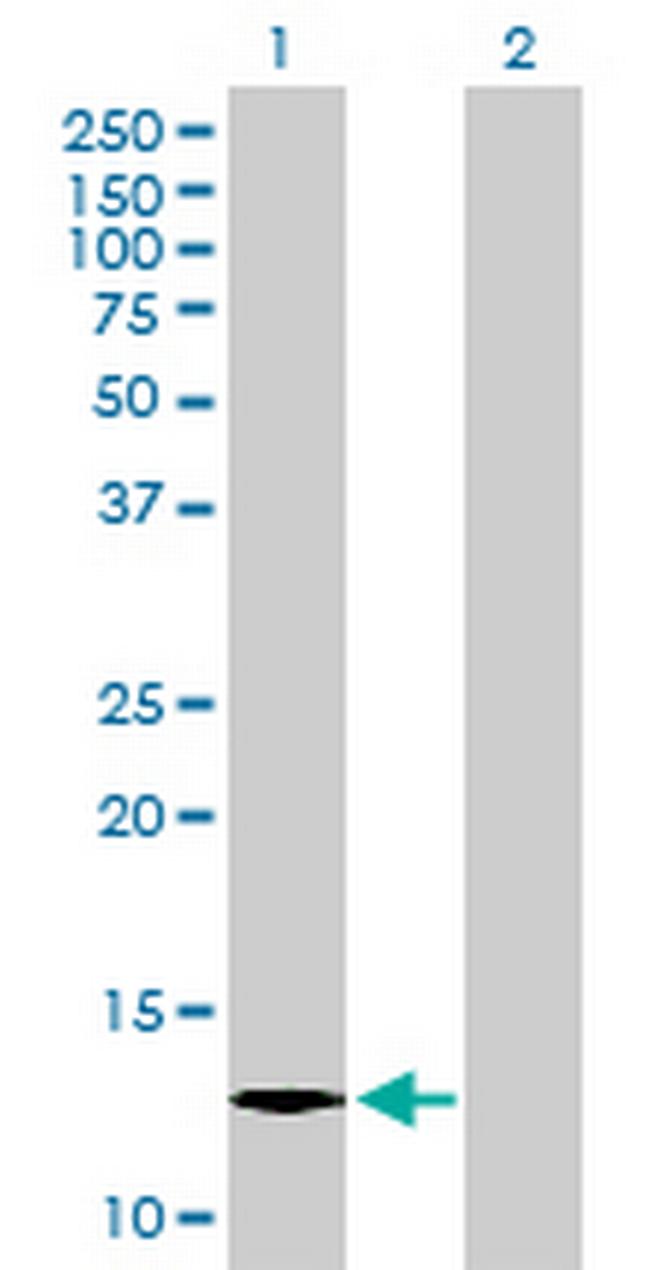 C1orf38 Antibody in Western Blot (WB)