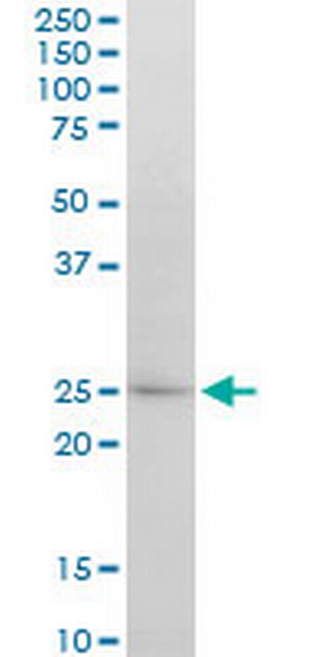 ATG5 Antibody in Western Blot (WB)