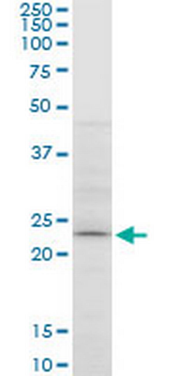 ATG5 Antibody in Western Blot (WB)