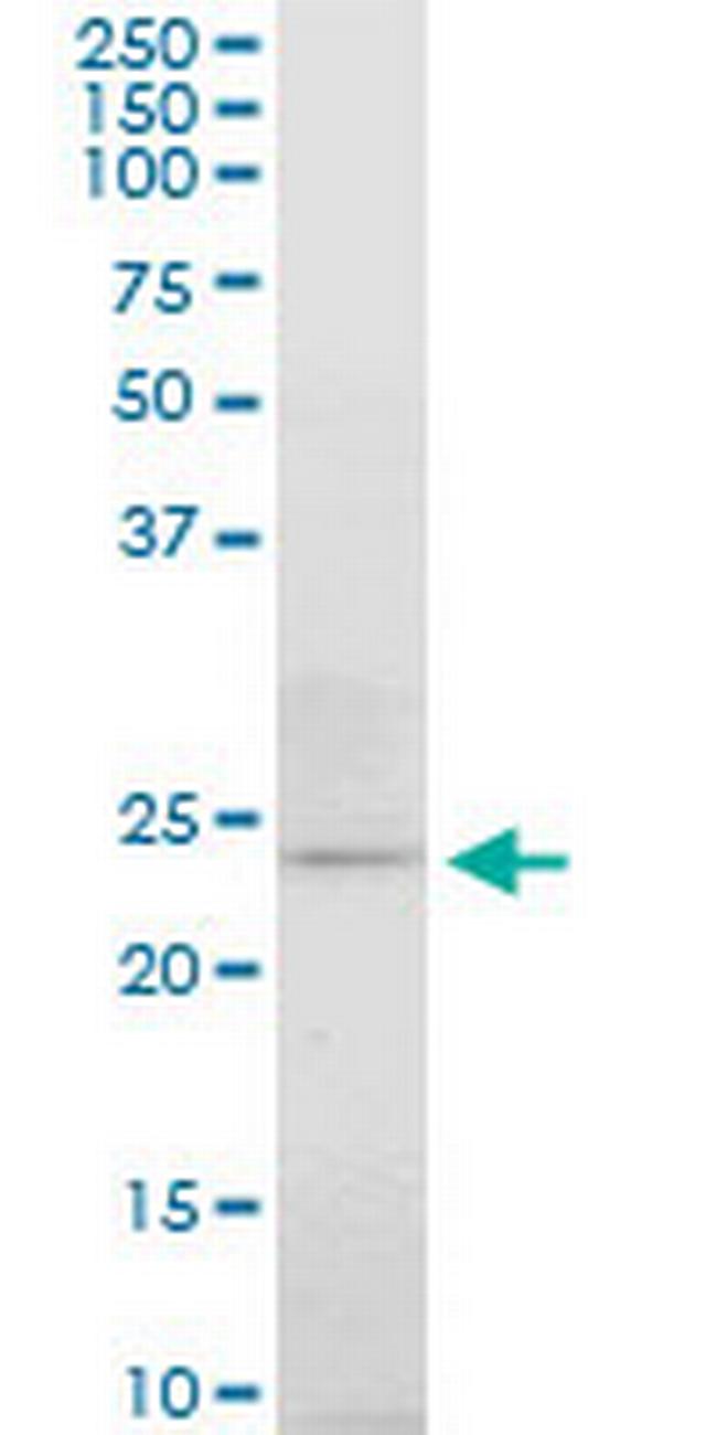 ATG5 Antibody in Western Blot (WB)