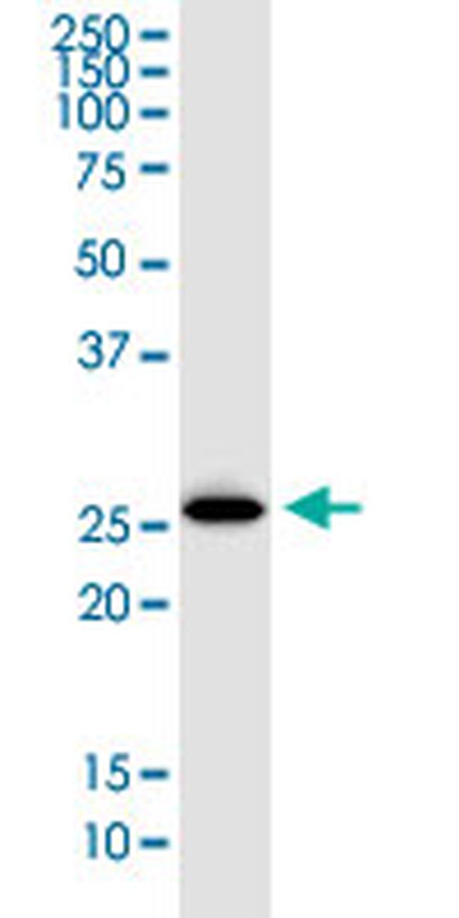 ATG5 Antibody in Western Blot (WB)