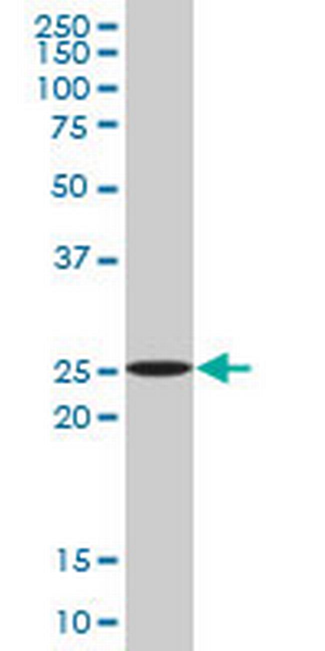 ATG5 Antibody in Western Blot (WB)