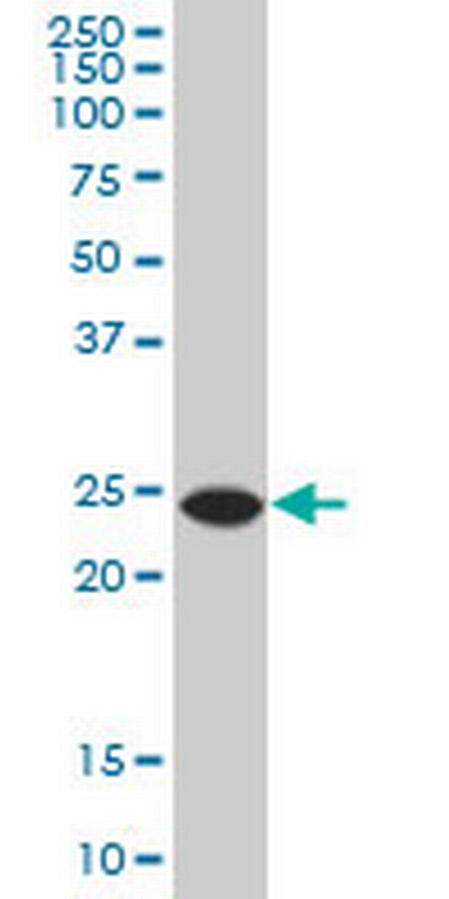 ATG5 Antibody in Western Blot (WB)