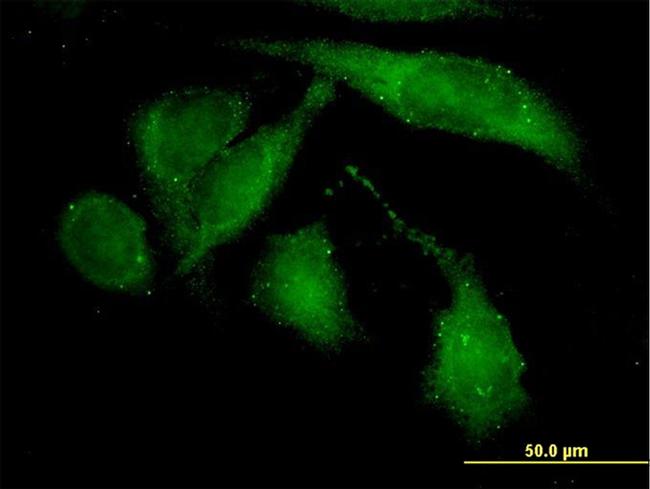 ROCK2 Antibody in Immunocytochemistry (ICC/IF)