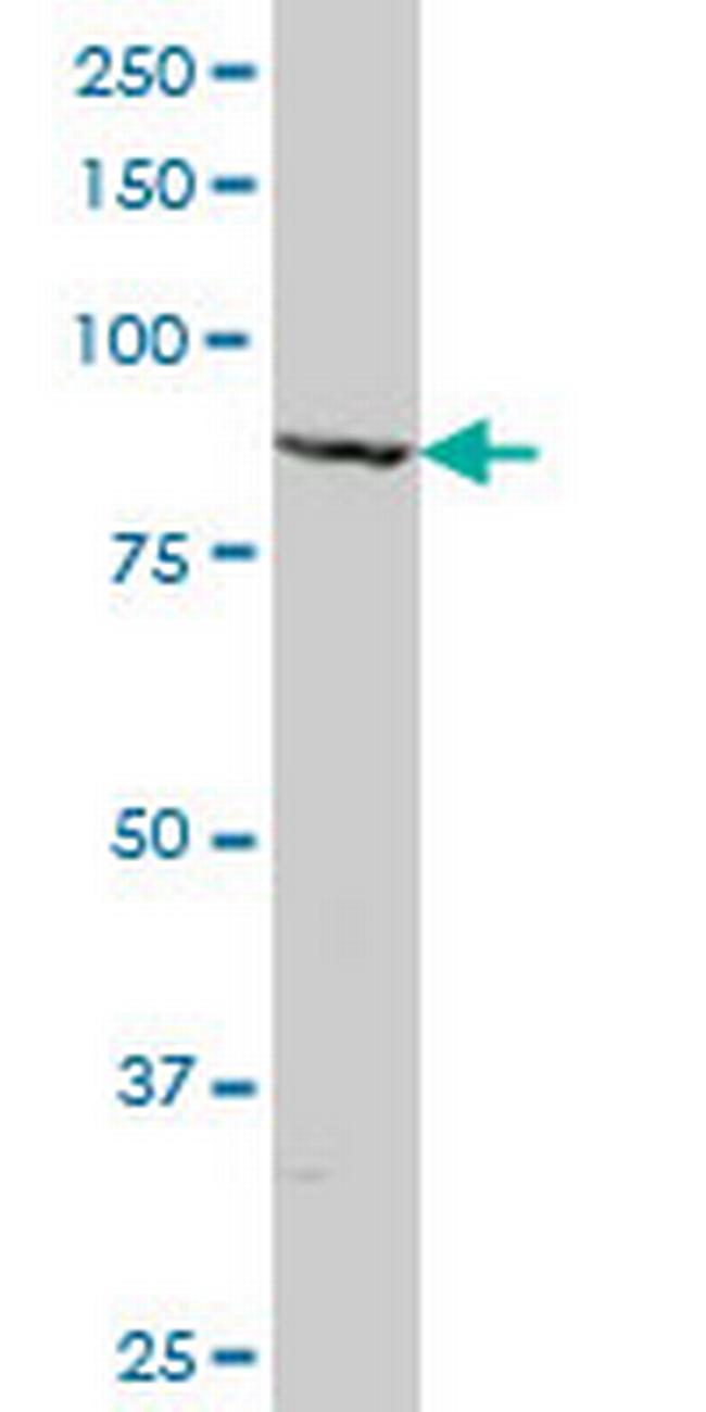 MAGED1 Antibody in Western Blot (WB)