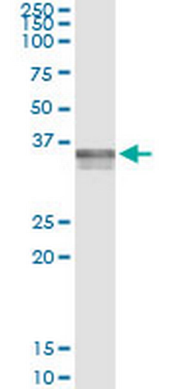 ADAMTS4 Antibody in Immunoprecipitation (IP)