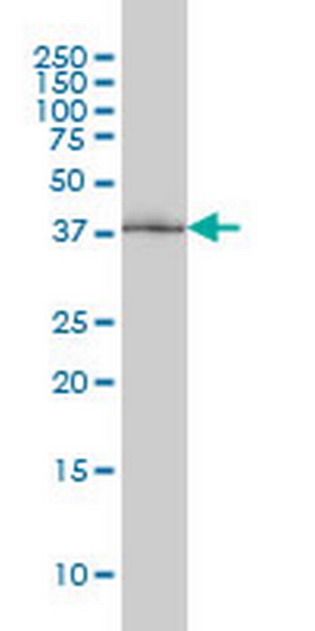 POLR1C Antibody in Western Blot (WB)