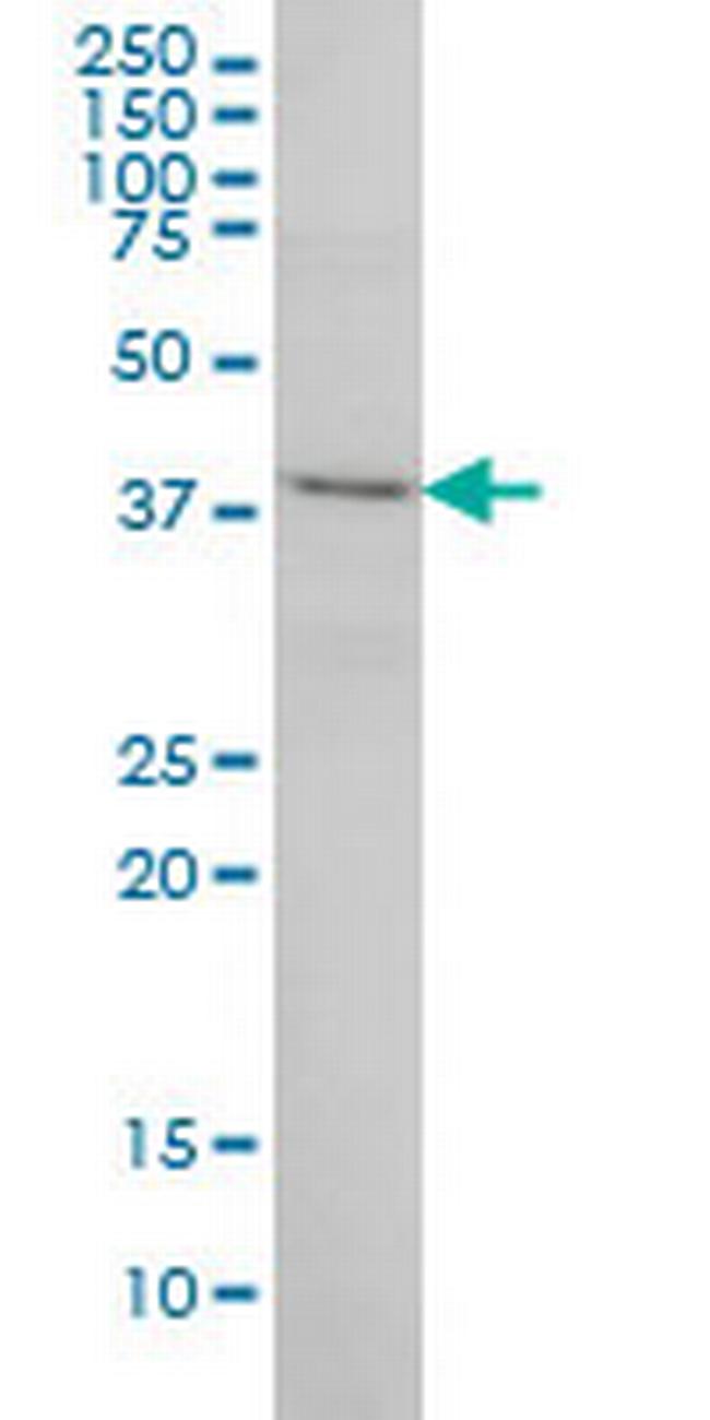 POLR1C Antibody in Western Blot (WB)